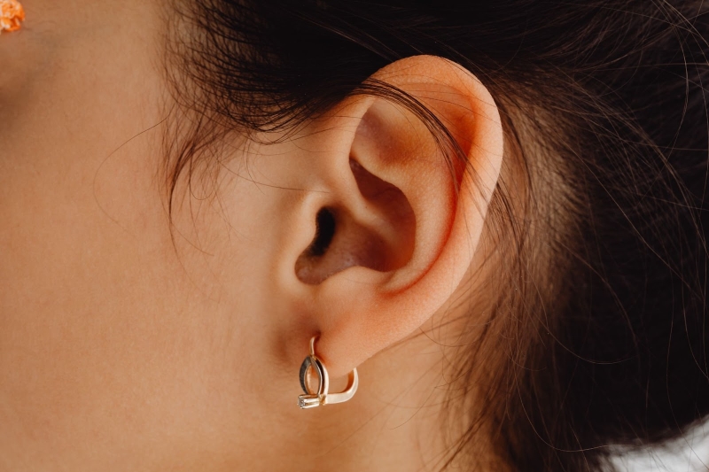 Can stretched earlobes be returned to normal?