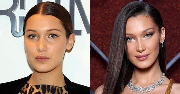 <Alt=https://www.elle.com.au/beauty/bella-hadid-before-after-18473> blepharoplasty is one surgical procedure that can flatter the rest of the face.